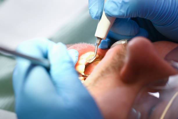 Best Cracked Tooth Emergency Dentist  in Hebron, OH
