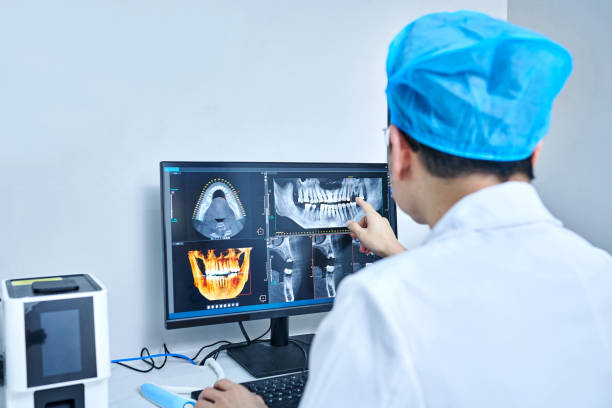 Best Chipped Tooth Repair Near Me  in Hebron, OH