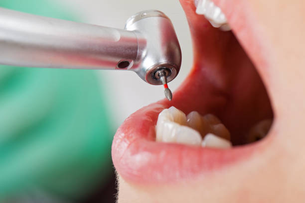 Best Emergency Gum Pain Relief  in Hebron, OH